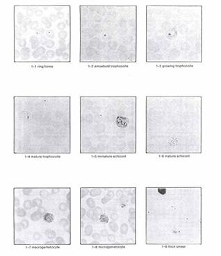 Read online Publications Combined: PARASITOLOGY I & II, BACTERIOLOGY, LABORATORY MATHEMATICS, GENERAL CHEMISTRY AND CLINICAL CHEMISTRY - U.S. Army Medical Department Center and School | ePub